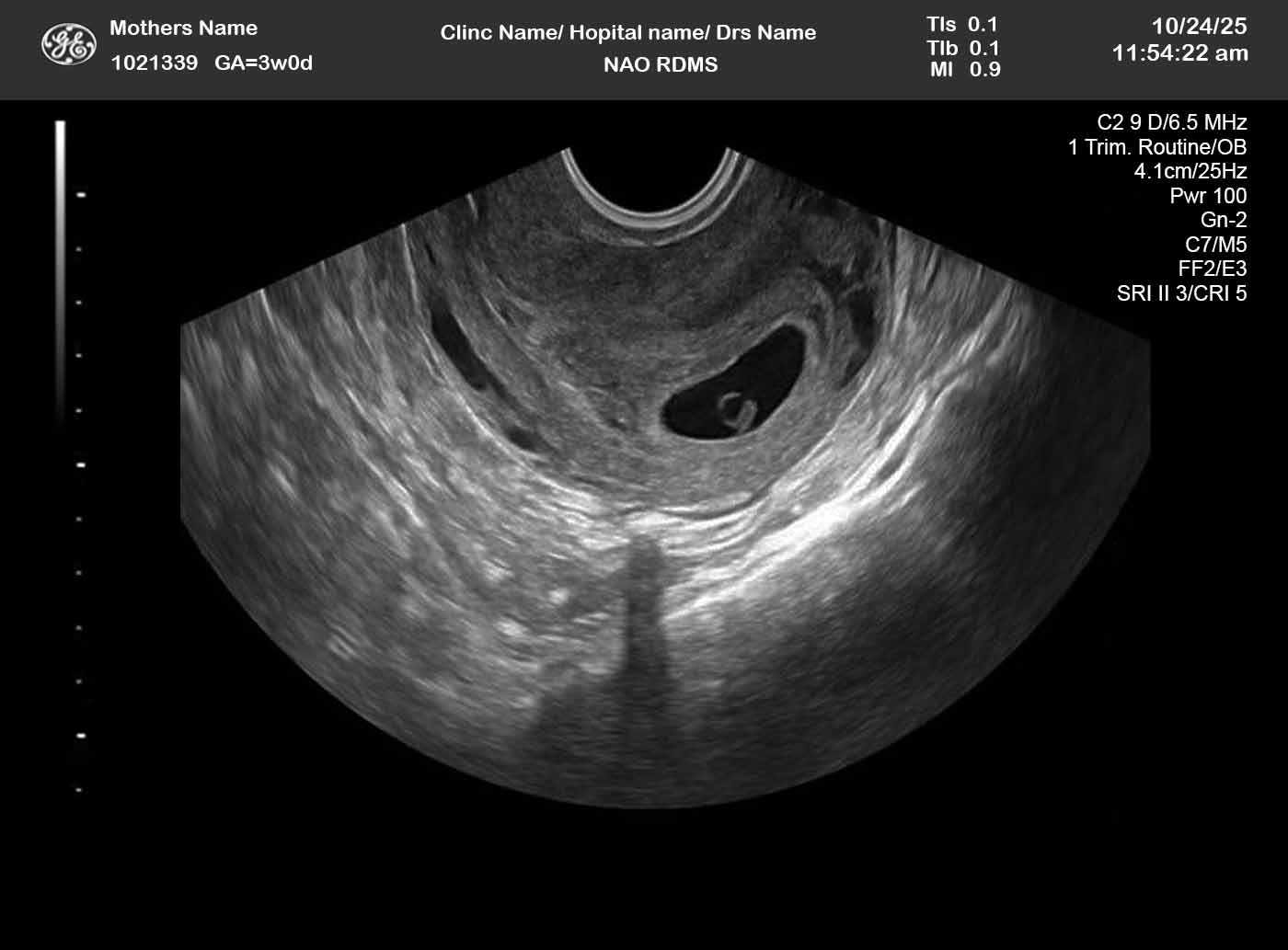 20-week ultrasound